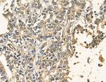 PRRX2 Antibody in Immunohistochemistry (Paraffin) (IHC (P))