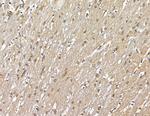 PRRX2 Antibody in Immunohistochemistry (Paraffin) (IHC (P))