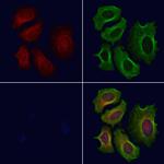 CROT Antibody in Immunocytochemistry (ICC/IF)