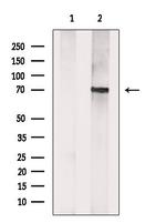 CROT Antibody in Western Blot (WB)