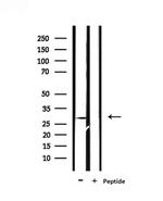 PEX11A Antibody in Western Blot (WB)