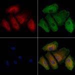 PAOX Antibody in Immunocytochemistry (ICC/IF)