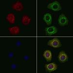 PEX6 Antibody in Immunocytochemistry (ICC/IF)