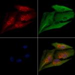 PEX12 Antibody in Immunocytochemistry (ICC/IF)