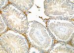 PEX12 Antibody in Immunohistochemistry (Paraffin) (IHC (P))