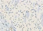 KCNE3 Antibody in Immunohistochemistry (Paraffin) (IHC (P))