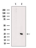 KCNE3 Antibody in Western Blot (WB)