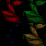 PPP1R3D Antibody in Immunocytochemistry (ICC/IF)