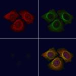 PPP1R3D Antibody in Immunocytochemistry (ICC/IF)