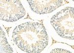 PPP1R3D Antibody in Immunohistochemistry (Paraffin) (IHC (P))