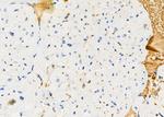 S100A7 Antibody in Immunohistochemistry (Paraffin) (IHC (P))