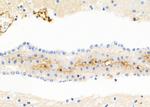 S100A7 Antibody in Immunohistochemistry (Paraffin) (IHC (P))