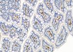 S100A7 Antibody in Immunohistochemistry (Paraffin) (IHC (P))