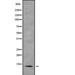 S100A7 Antibody in Western Blot (WB)