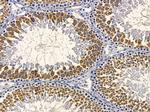 RAB1A Antibody in Immunohistochemistry (Paraffin) (IHC (P))