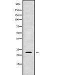 RAB1A Antibody in Western Blot (WB)