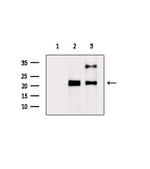 RAB22A Antibody in Western Blot (WB)