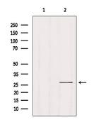 RAB33B Antibody in Western Blot (WB)