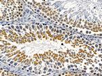 RAB5B Antibody in Immunohistochemistry (Paraffin) (IHC (P))