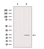 RAB6B Antibody in Western Blot (WB)