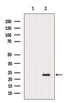 RAB8A Antibody in Western Blot (WB)