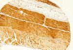 RAB9B Antibody in Immunohistochemistry (Paraffin) (IHC (P))