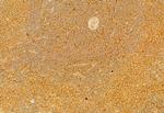 RAB9B Antibody in Immunohistochemistry (Paraffin) (IHC (P))