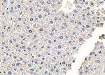 PTPRK Antibody in Immunohistochemistry (Paraffin) (IHC (P))