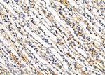 PTPRK Antibody in Immunohistochemistry (Paraffin) (IHC (P))