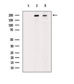 PTPRK Antibody in Western Blot (WB)