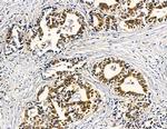 RGS20 Antibody in Immunohistochemistry (Paraffin) (IHC (P))