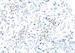 BMS1 Antibody in Immunohistochemistry (Paraffin) (IHC (P))