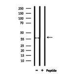 FRZB Antibody in Western Blot (WB)