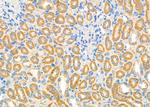 SRR Antibody in Immunohistochemistry (Paraffin) (IHC (P))