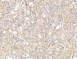 SH3PXD2A Antibody in Immunohistochemistry (Paraffin) (IHC (P))