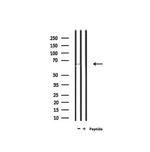 SLC6A20 Antibody in Western Blot (WB)