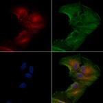 SCN11A Antibody in Immunocytochemistry (ICC/IF)