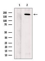 SCN11A Antibody in Western Blot (WB)