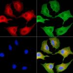 SLC28A1 Antibody in Immunocytochemistry (ICC/IF)