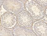 SPAG5 Antibody in Immunohistochemistry (Paraffin) (IHC (P))