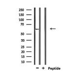 ZNF280B Antibody in Western Blot (WB)