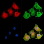 TRAK2 Antibody in Immunocytochemistry (ICC/IF)