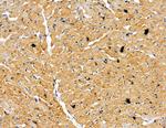 TRAK2 Antibody in Immunohistochemistry (Paraffin) (IHC (P))