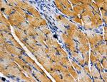 TRAK2 Antibody in Immunohistochemistry (Paraffin) (IHC (P))