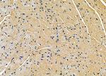 TRAK2 Antibody in Immunohistochemistry (Paraffin) (IHC (P))