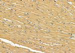 TRAK2 Antibody in Immunohistochemistry (Paraffin) (IHC (P))