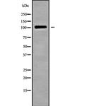 TRAK2 Antibody in Western Blot (WB)