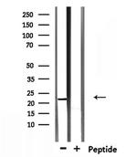 TCEAL5 Antibody in Western Blot (WB)