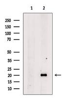 TNNT1 Antibody in Western Blot (WB)