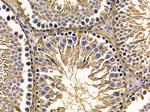 USP6 Antibody in Immunohistochemistry (Paraffin) (IHC (P))